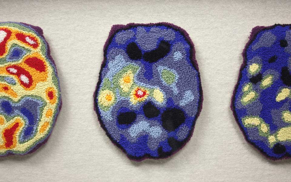 RUN OVER BY MY OWN PARADE | Brain patterns of mental health conditions in needle punched wool 15cm x 12cm (each).